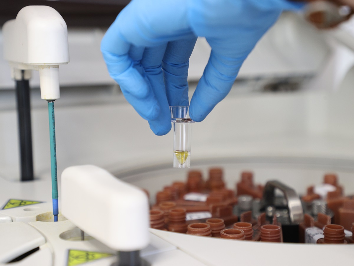 Хороший холестерин разрушает мозг: для каких людей он под запретом