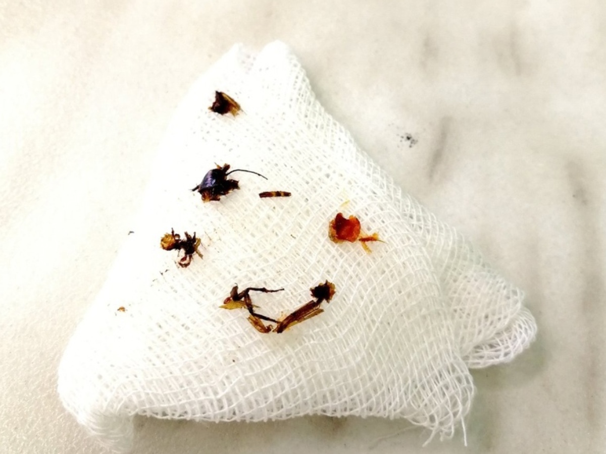 сороконожка двухвостка. достали таракана из уха. достали таракана из уха.