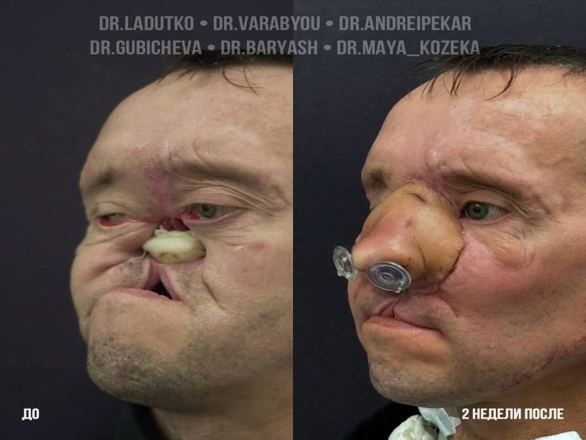 «операция»