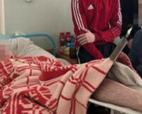 В городе Скопин Рязанской области 18-летний парень упал с ледяной лестницы и сломал бедро