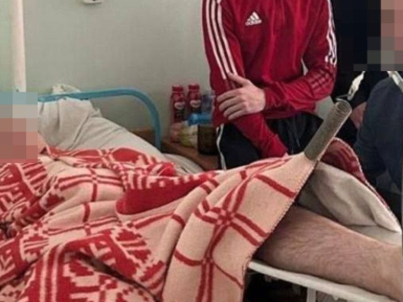 В городе Скопин Рязанской области 18-летний парень упал с ледяной лестницы и сломал бедро