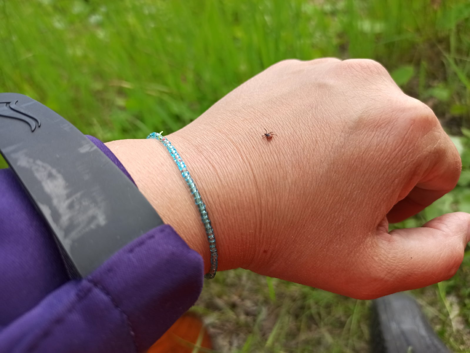 В Ивановской области нашествие клещей