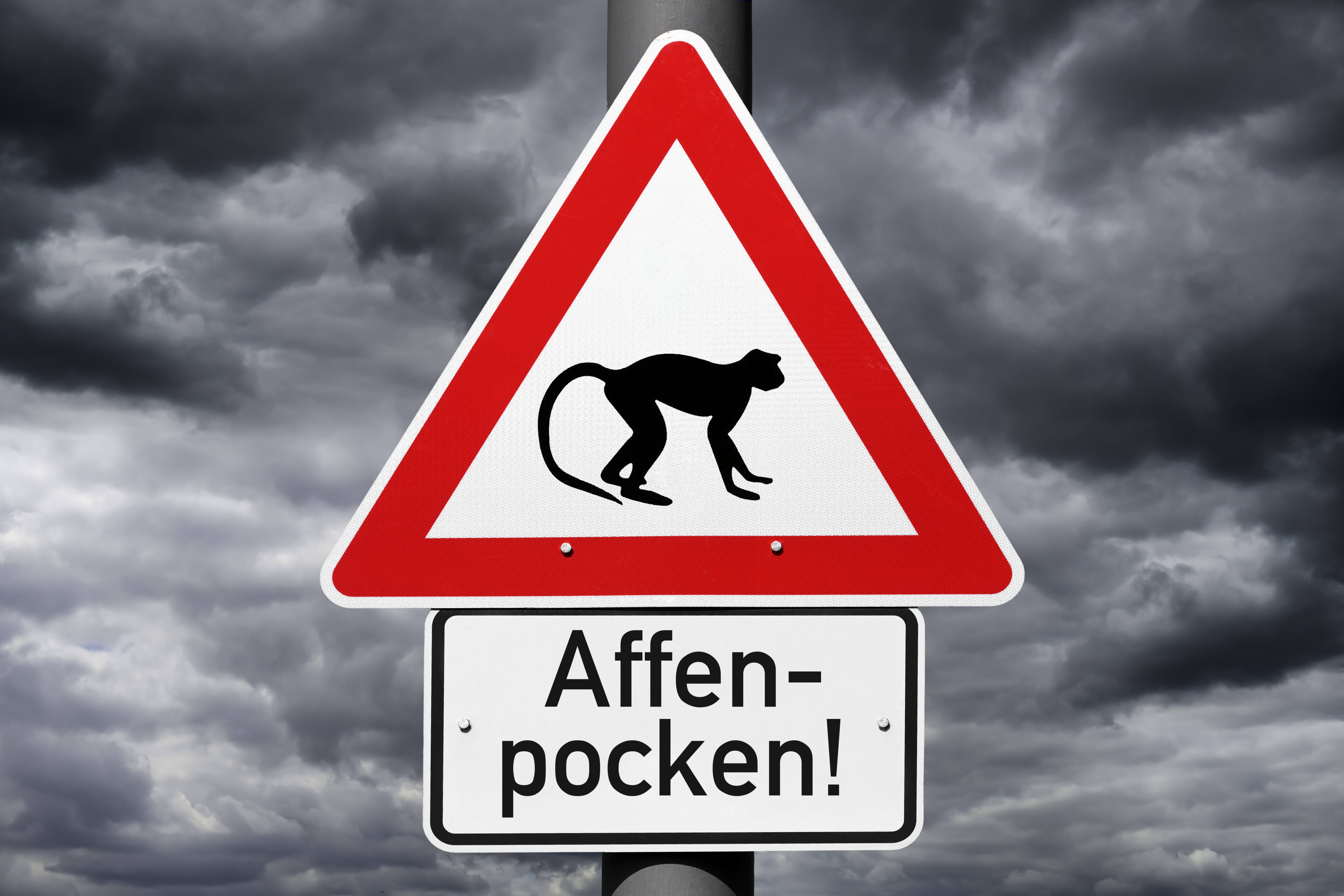 Оспа обезьян в России: Роспотребнадзор уверяет в безопасности