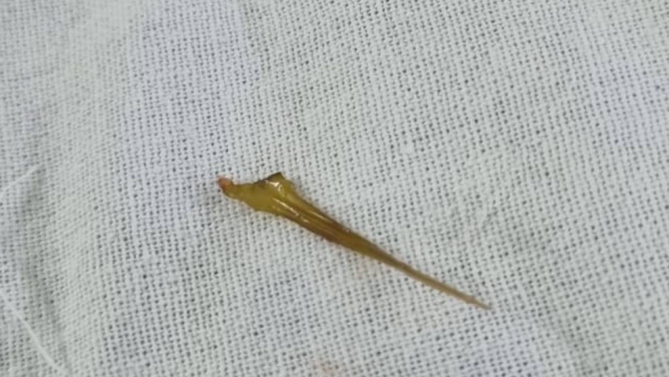 рыбная кость