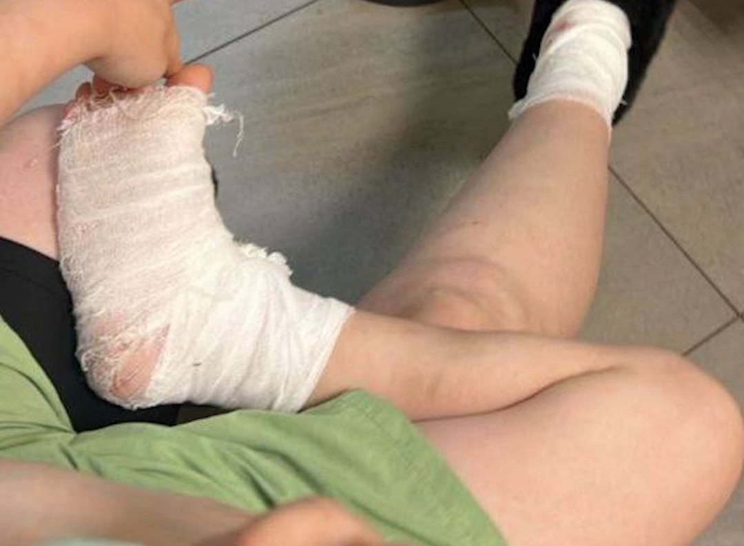 пострадавший мальчик