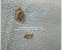 клюв в котлете