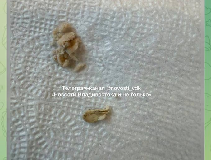 клюв в котлете