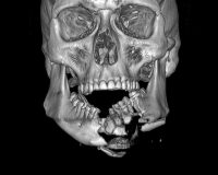 собрали челюсть