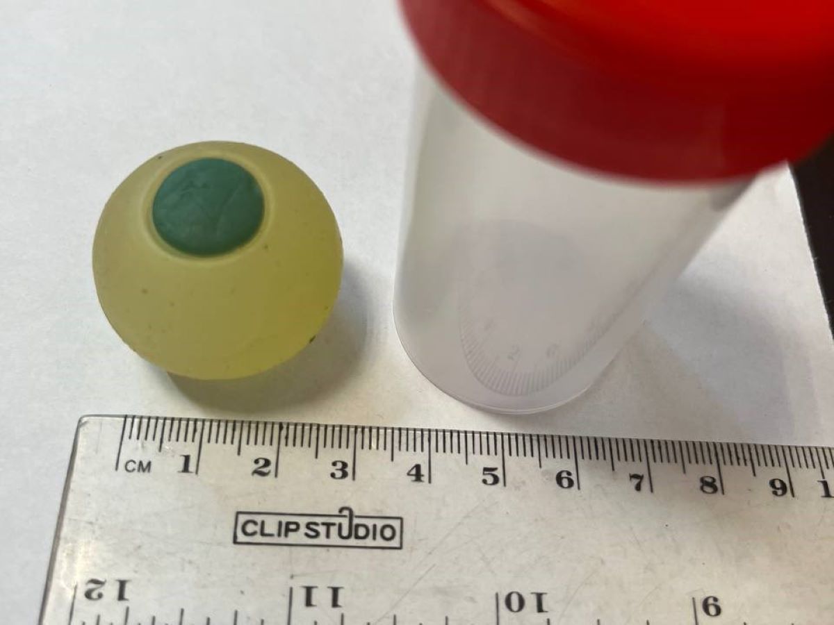 глаз из ребенка