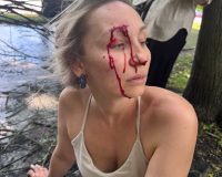 В Кремлёвском парке Великого Новгорода рухнувшее дерево поранило девушку