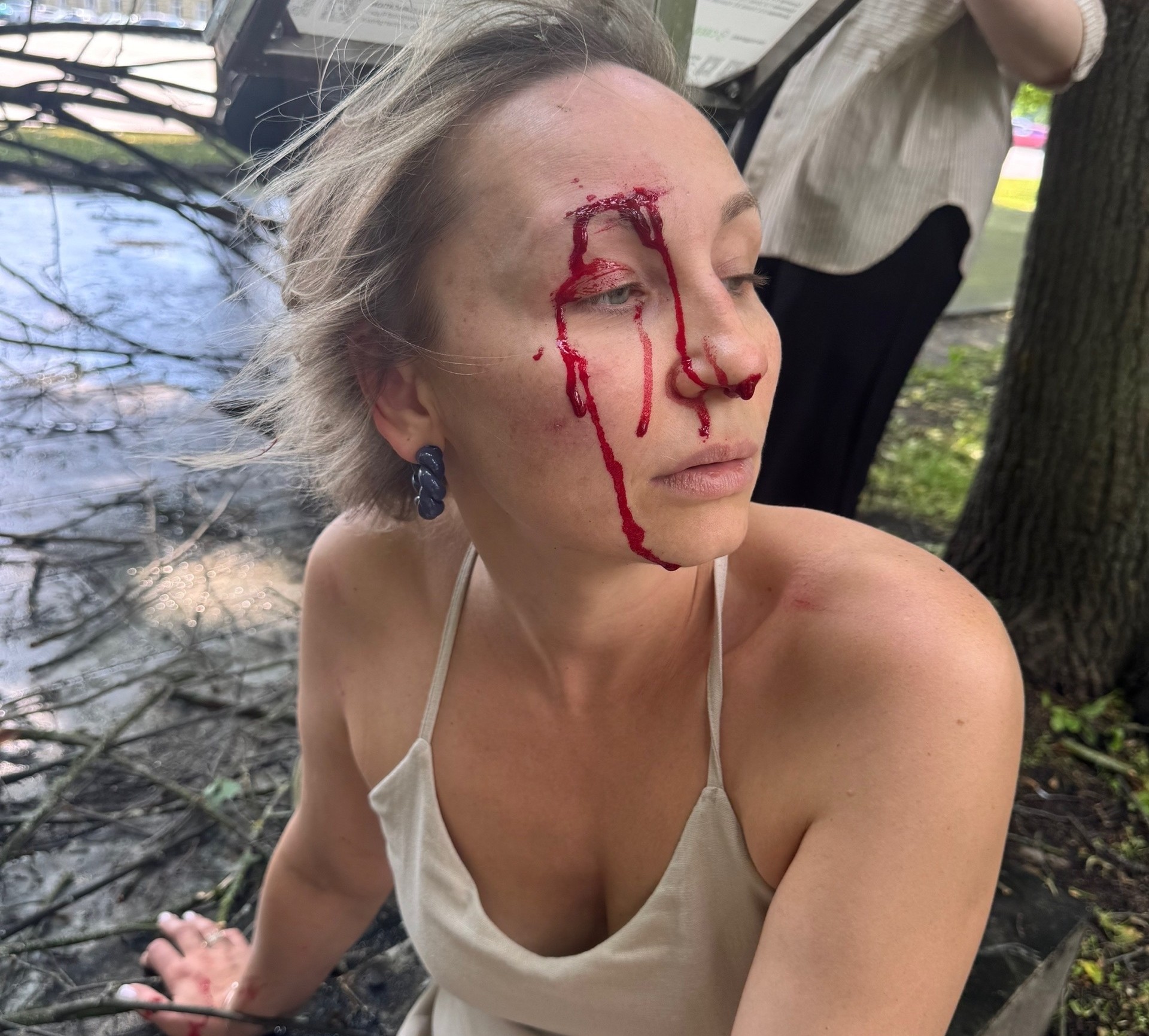 В Кремлёвском парке Великого Новгорода рухнувшее дерево поранило девушку