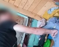 Пензячка после ссоры и драки с приятелем ушла домой и там скончалась